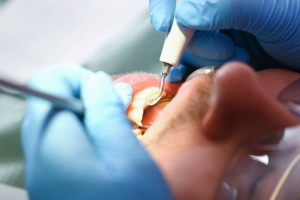 Best Emergency Denture Repair in Cressona, PA